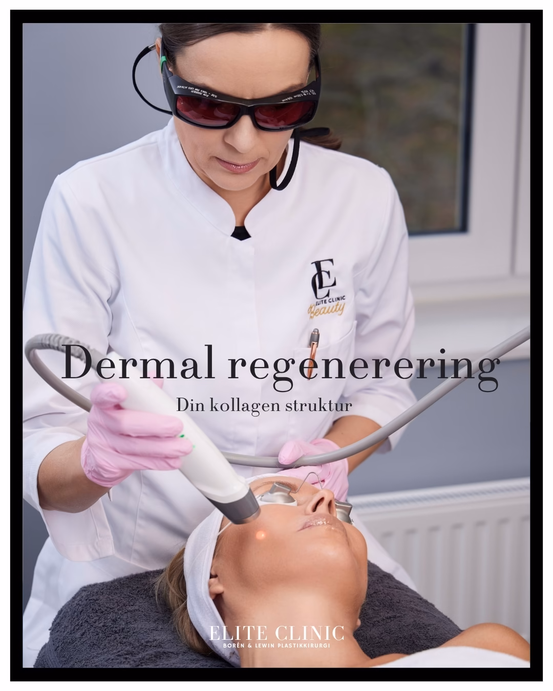 Laser Facial - Kollagenstruktur