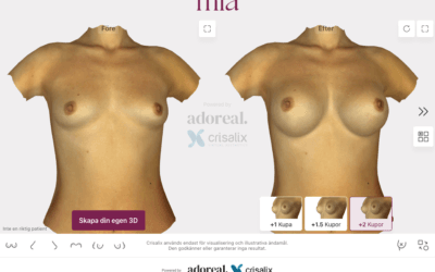 3D-simulering av Mia Femtech bröstutfyllnad hemma