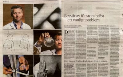 Besvär av för stora bröst – ett vanligt problem